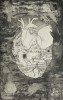 Lauros Adomavičiūtės Sargent ofortas